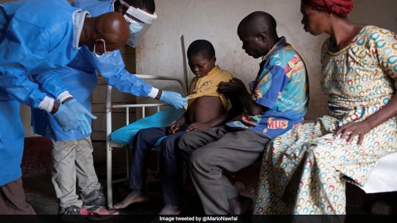 Mystery Disease In Congo Kills More Than 50 People, WHO On Alert